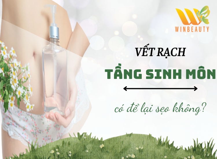 Winbeauty: Winbeauty cung cấp các dịch vụ làm đẹp chuyên nghiệp nhất. Với một số liệu khách hàng tuyệt vời và rất nhiều lựa chọn dịch vụ, Winbeauty sẽ làm cho bạn thấy yên tâm hơn về sự lựa chọn của mình. Hãy cùng khám phá các dịch vụ làm đẹp tại Winbeauty hôm nay.